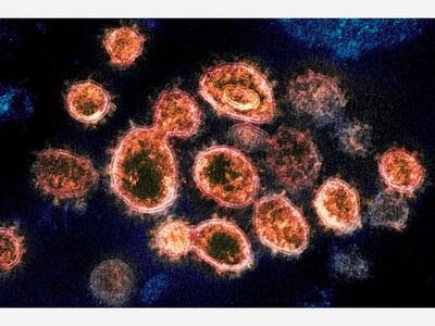 Str8 Out of Kentucky: COVID Virus Version R.1 Lands in Georgia